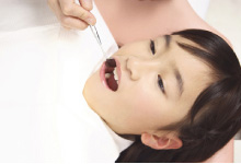 【高松市】虫歯予防にはミュータンス菌の感染を防ぐことが大切！予防歯科のあるサンシャイン歯科へ