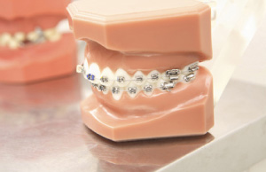 高松で矯正歯科をお考えなら、床矯正やムーシールドなどに対応する【サンシャイン歯科】へ