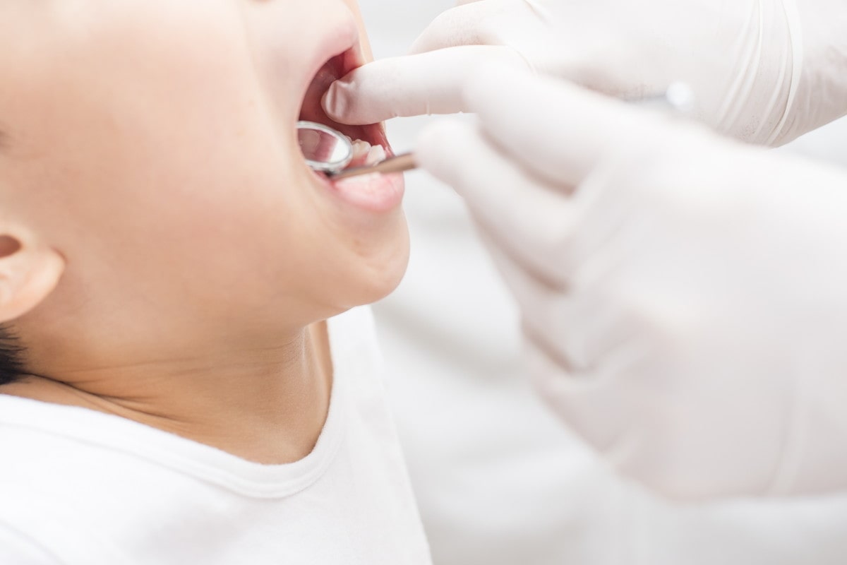 高松市で虫歯治療なら歯医者　サンシャイン歯科